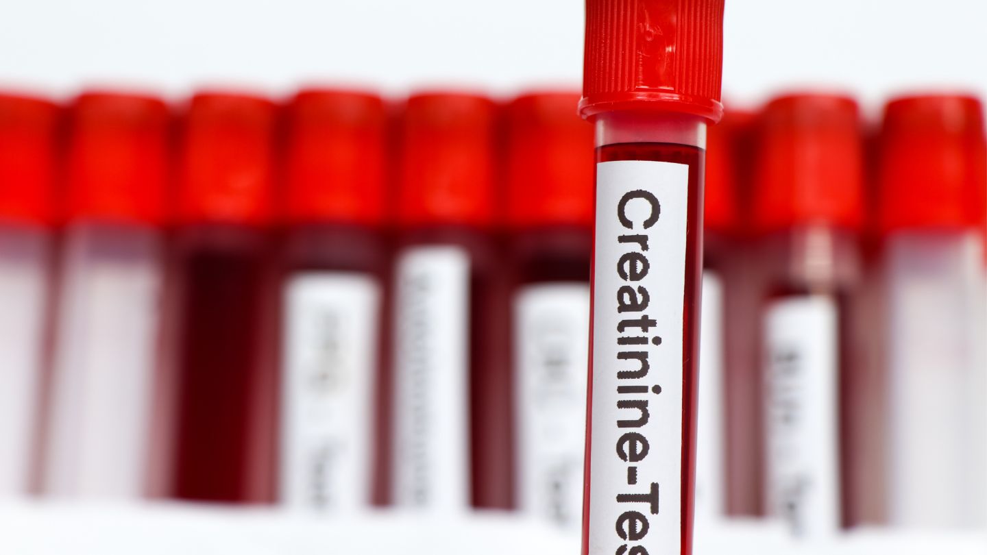 When to worry about creatinine levels key signs to watch